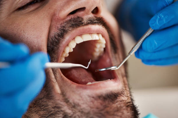 Best Emergency Treatment for Toothache in Whitehall, MI